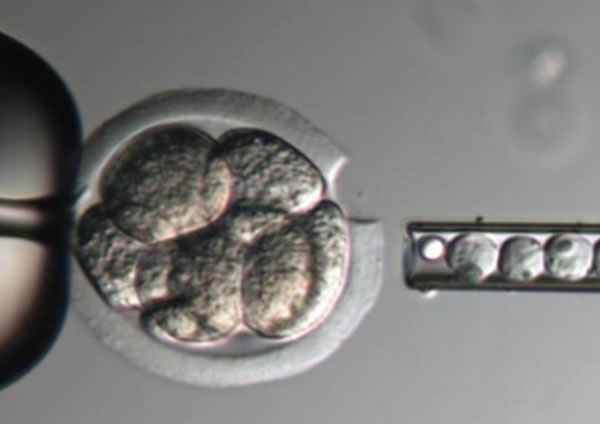 Embrião sendo rompido na técnica de Assisted Hatching